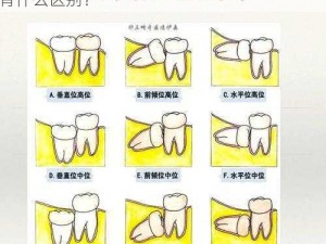 拔上智齿和下智齿的区别_拔上智齿和下智齿有什么区别？