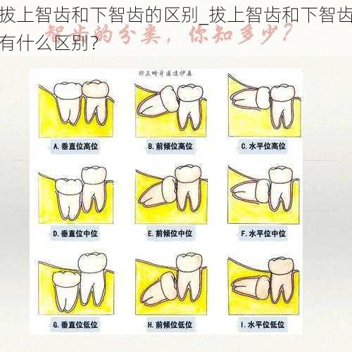 拔上智齿和下智齿的区别_拔上智齿和下智齿有什么区别？