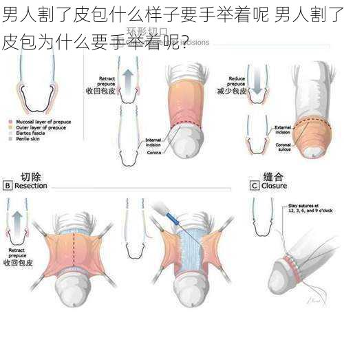 男人割了皮包什么样子要手举着呢 男人割了皮包为什么要手举着呢？